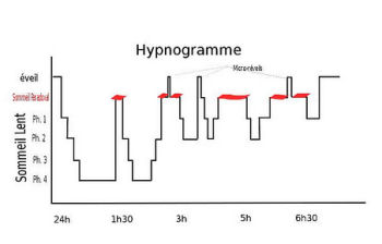 Hypogramme